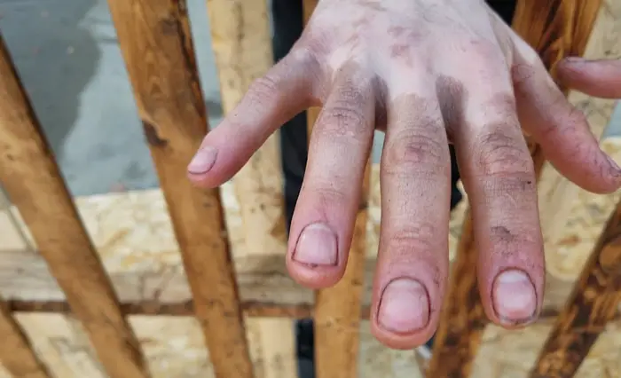 How to Remove Oil-Based Polyurethane From Hands and Skin